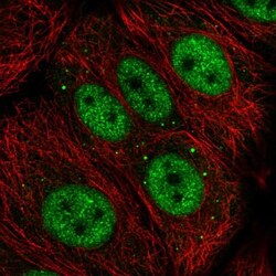 ZGLP1 Antibody, Novus Biologicals 25 &mu;L, Unlabeled:Antibodies, Polyclonal